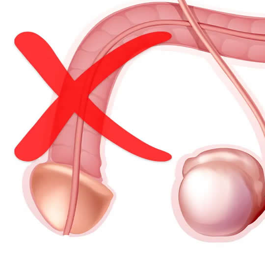 disfuncion erectil en quito