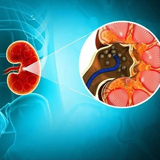 ENDOUROOGIA HOLEP EN QUITO